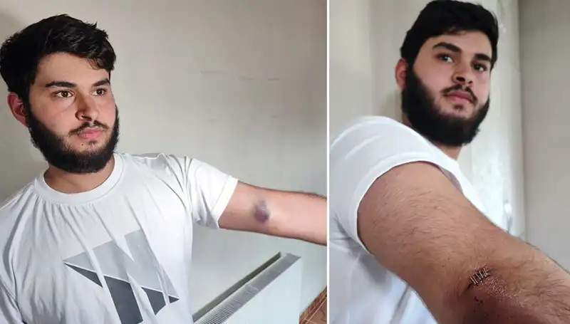 Bahçeye Kaçan Top, Mahallede Gülüşmelere Neden Oldu!
