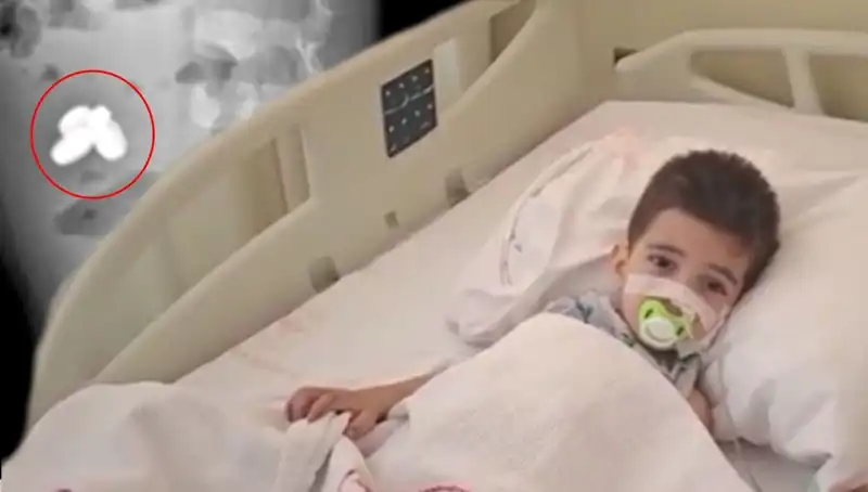 Küçük Çocuğun Hayatını Tehdit Eden Korkunç Olay: Pil ve Mıknatıs Yuttu!